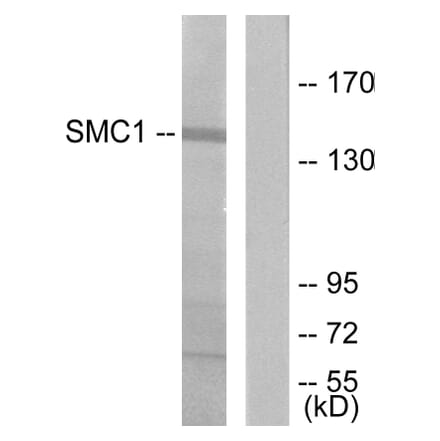 Western Blot - Anti-SMC1 Antibody (B7217) - Antibodies.com