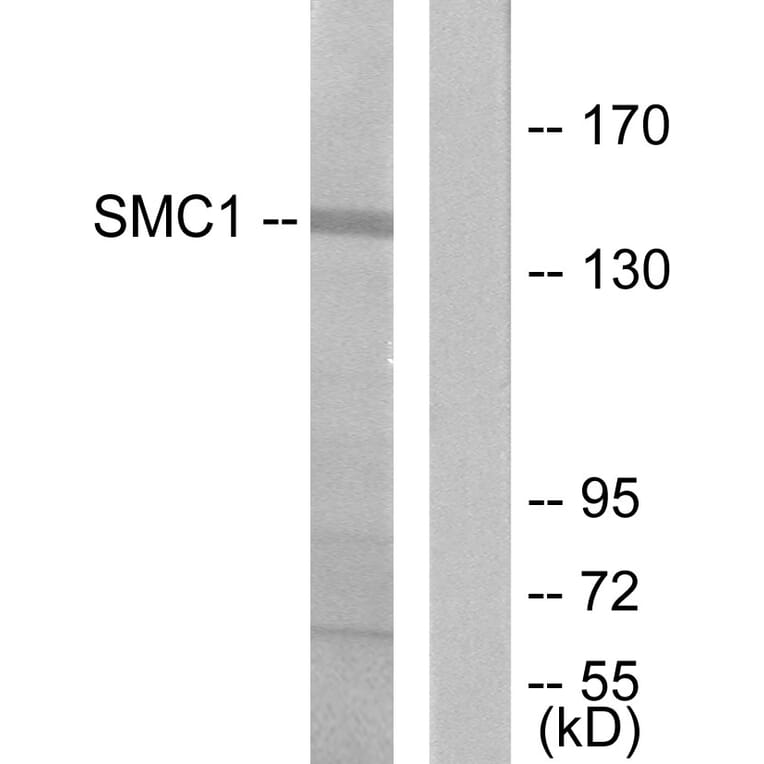 Western Blot - Anti-SMC1 Antibody (B7217) - Antibodies.com