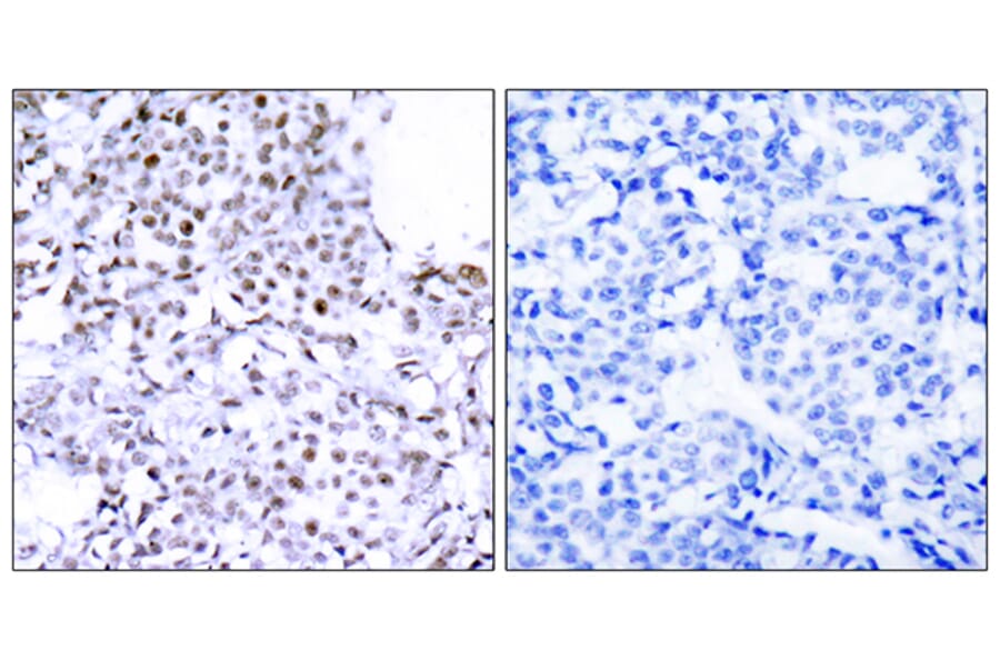 Immunohistochemistry - Anti-SMC1 Antibody (B7217) - Antibodies.com