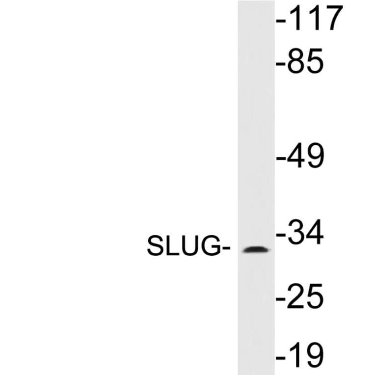 Western Blot - Anti-SLUG Antibody (R12-2357) - Antibodies.com