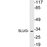 Western Blot - Anti-SLUG Antibody (R12-2357) - Antibodies.com