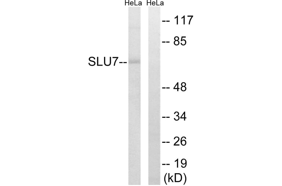 Western Blot - Anti-SLU7 Antibody (C17858) - Antibodies.com