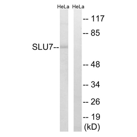 Western Blot - Anti-SLU7 Antibody (C17858) - Antibodies.com