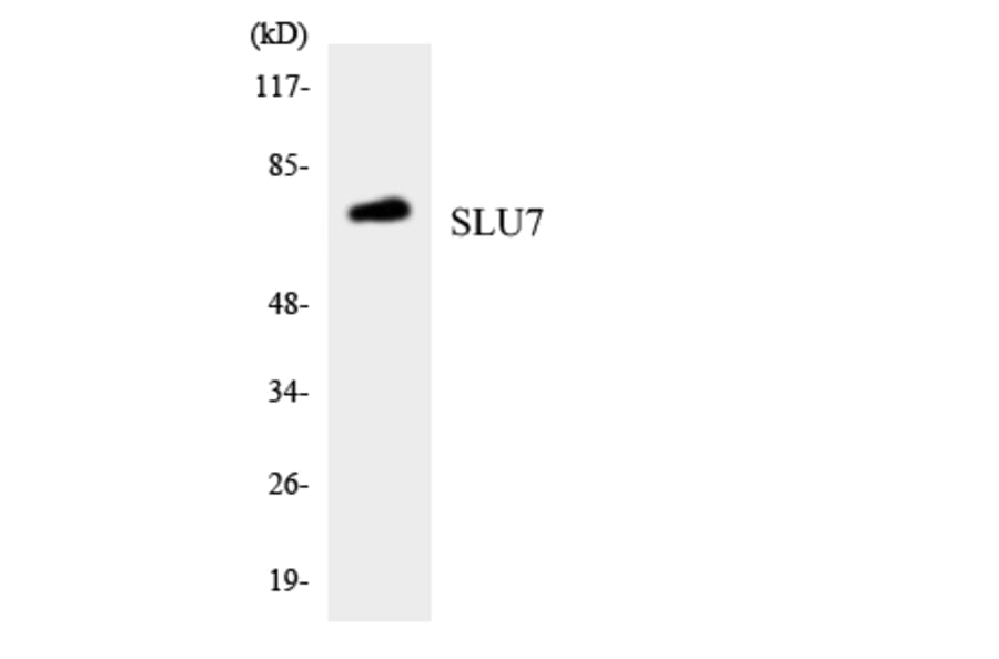 Western Blot - Anti-SLU7 Antibody (R12-3543) - Antibodies.com