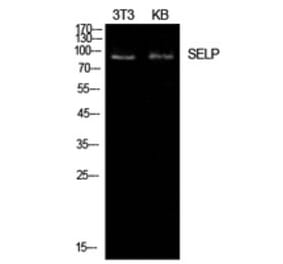 Western Blot - Anti-SELP Antibody (C30371) - Antibodies.com