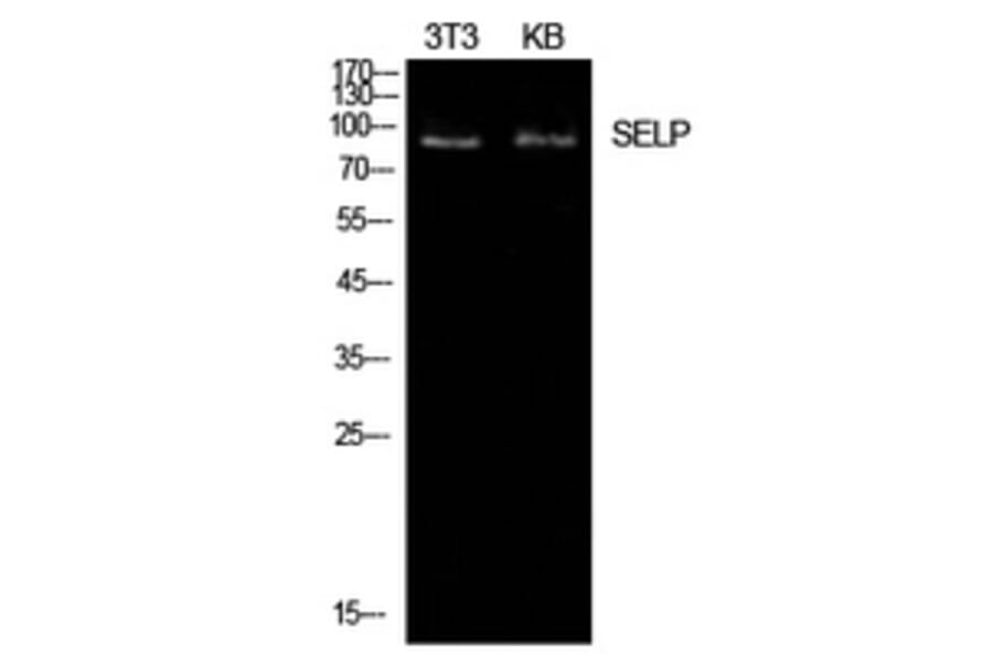 Western Blot - Anti-SELP Antibody (C30371) - Antibodies.com