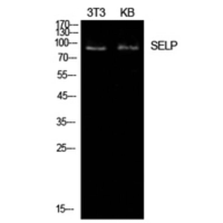 Western Blot - Anti-SELP Antibody (C30371) - Antibodies.com