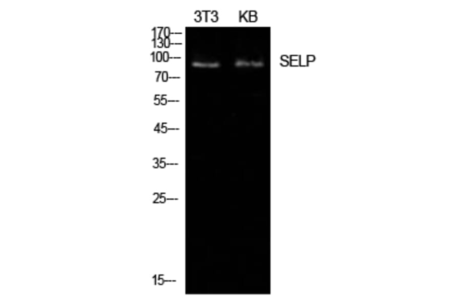 Western Blot - Anti-SELP Antibody (C30371) - Antibodies.com