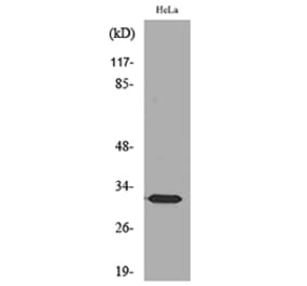 Western Blot - Anti-SDHB Antibody (C30270) - Antibodies.com