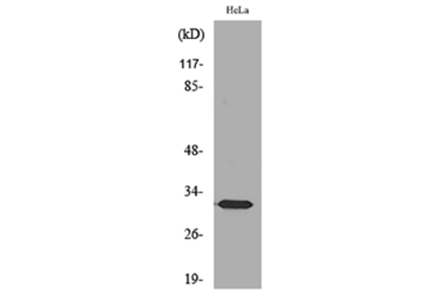 Western Blot - Anti-SDHB Antibody (C30270) - Antibodies.com