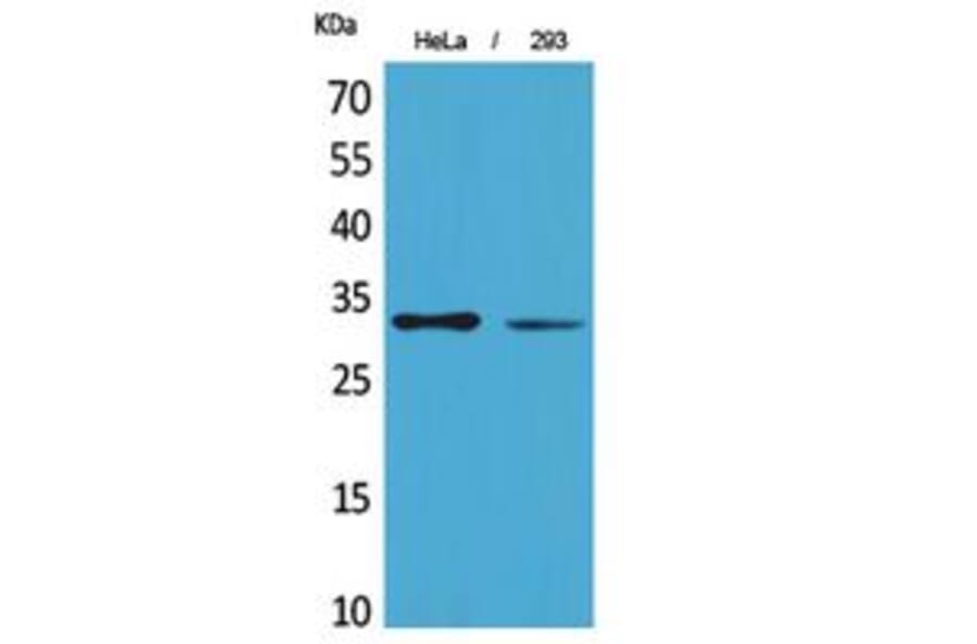 Western Blot - Anti-SDHB Antibody (C30270) - Antibodies.com