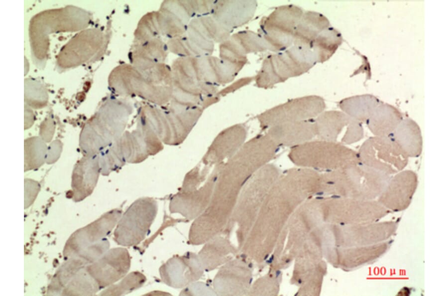 Immunohistochemistry - Anti-SDHB Antibody (C30270) - Antibodies.com