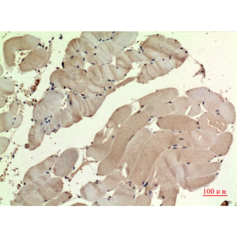 Immunohistochemistry - Anti-SDHB Antibody (C30270) - Antibodies.com