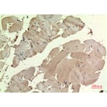 Immunohistochemistry - Anti-SDHB Antibody (C30270) - Antibodies.com