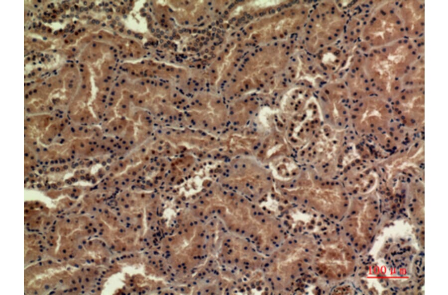 Immunohistochemistry - Anti-SDHB Antibody (C30270) - Antibodies.com