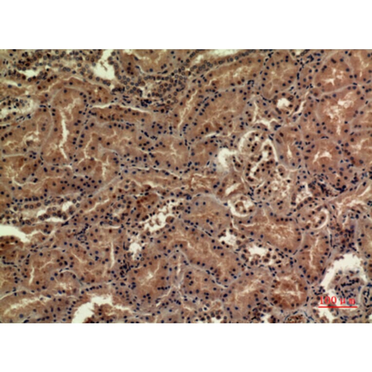 Immunohistochemistry - Anti-SDHB Antibody (C30270) - Antibodies.com