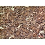 Immunohistochemistry - Anti-SDHB Antibody (C30270) - Antibodies.com