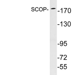 Western Blot - Anti-SCOP Antibody (R12-2346) - Antibodies.com