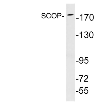 Western Blot - Anti-SCOP Antibody (R12-2346) - Antibodies.com