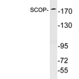 Western Blot - Anti-SCOP Antibody (R12-2346) - Antibodies.com