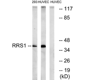 Western Blot - Anti-RRS1 Antibody (C18435) - Antibodies.com