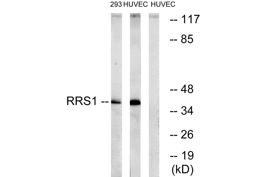 Western Blot - Anti-RRS1 Antibody (C18435) - Antibodies.com