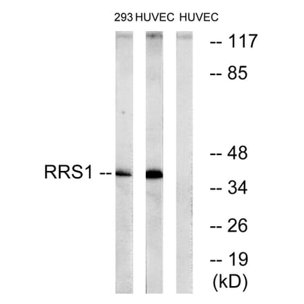 Western Blot - Anti-RRS1 Antibody (C18435) - Antibodies.com