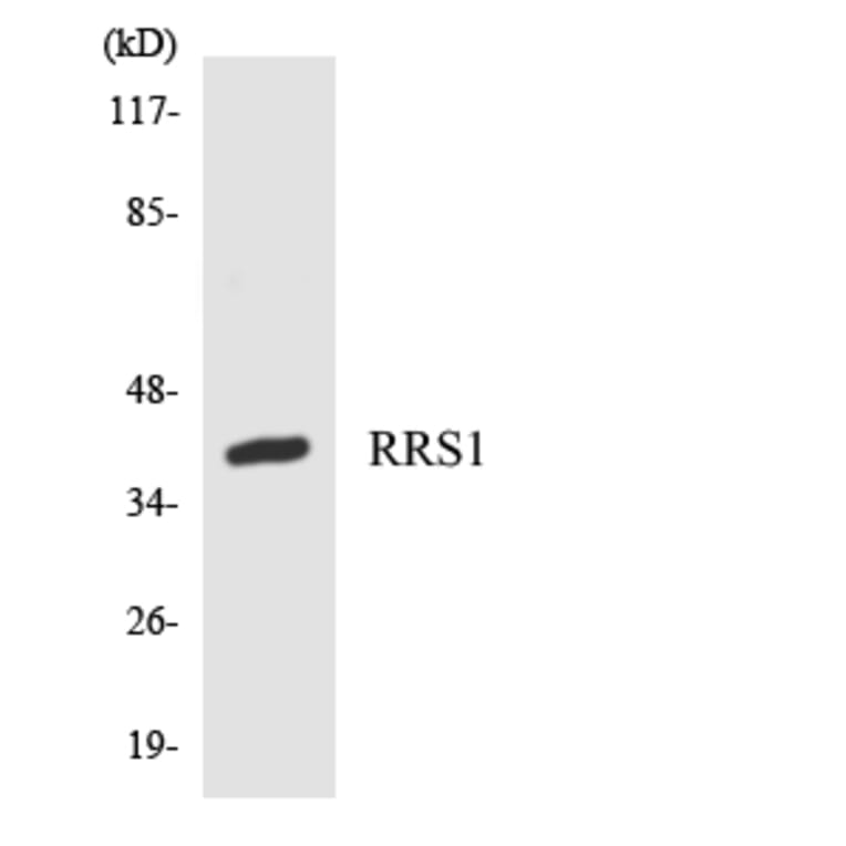 Western Blot - Anti-RRS1 Antibody (R12-3470) - Antibodies.com