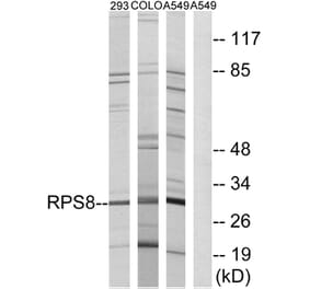 Western Blot - Anti-RPS8 Antibody (C14126) - Antibodies.com