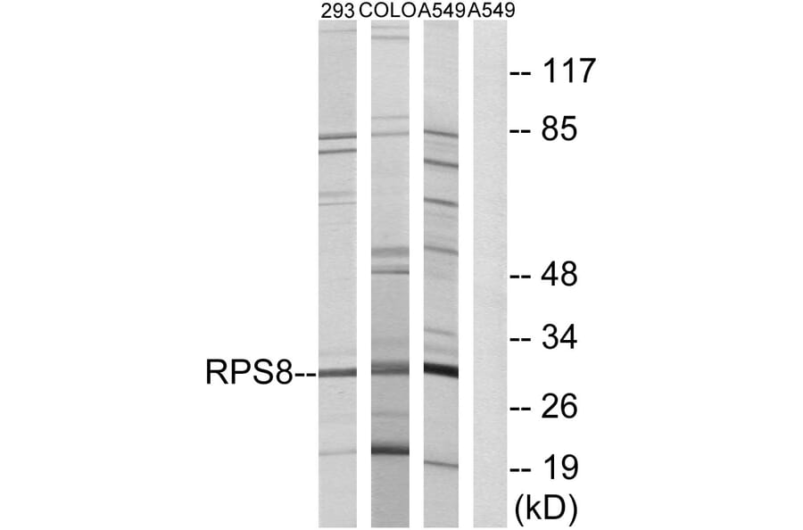Western Blot - Anti-RPS8 Antibody (C14126) - Antibodies.com