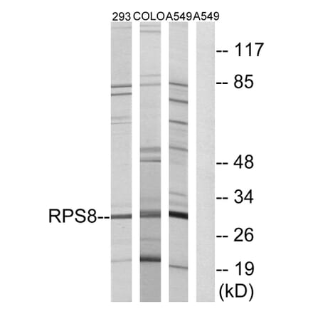 Western Blot - Anti-RPS8 Antibody (C14126) - Antibodies.com