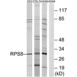 Western Blot - Anti-RPS8 Antibody (C14126) - Antibodies.com