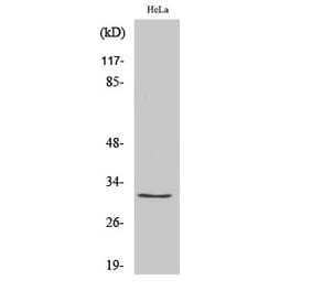 Western Blot - Anti-RPS2 Antibody (C14105) - Antibodies.com