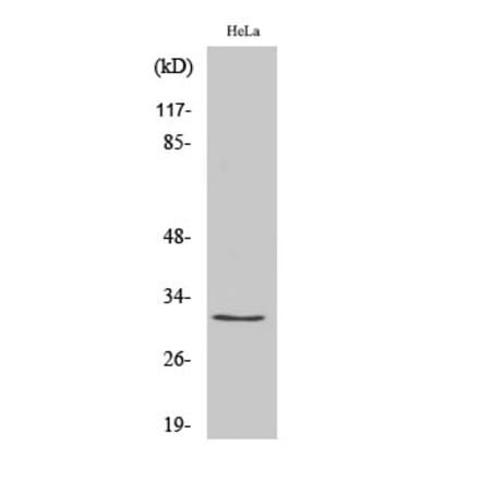 Western Blot - Anti-RPS2 Antibody (C14105) - Antibodies.com