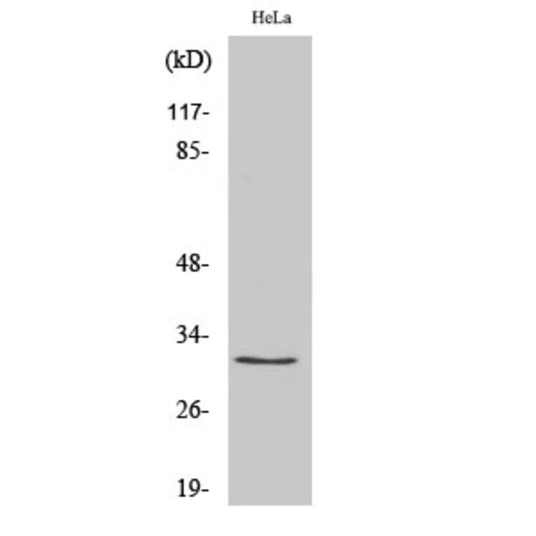 Western Blot - Anti-RPS2 Antibody (C14105) - Antibodies.com