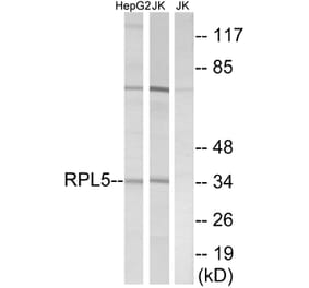 Western Blot - Anti-RPL5 Antibody (C14187) - Antibodies.com