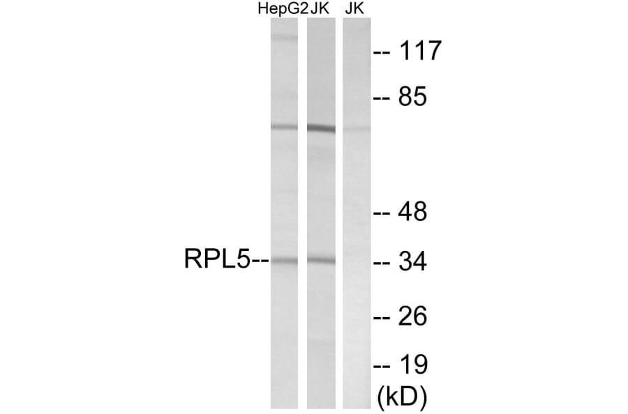 Western Blot - Anti-RPL5 Antibody (C14187) - Antibodies.com