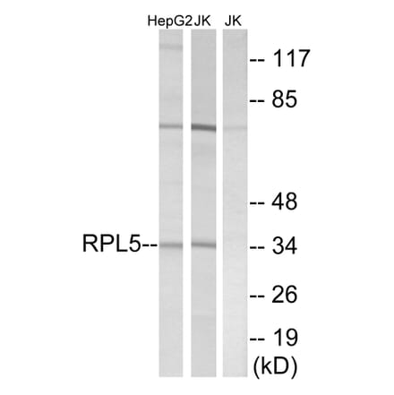 Western Blot - Anti-RPL5 Antibody (C14187) - Antibodies.com