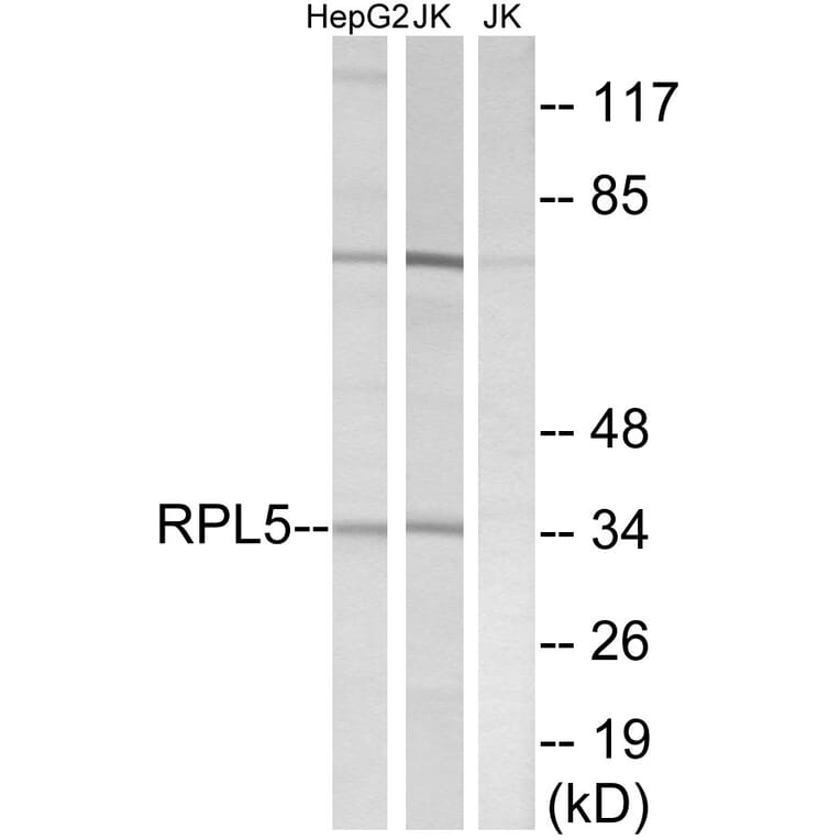Western Blot - Anti-RPL5 Antibody (C14187) - Antibodies.com