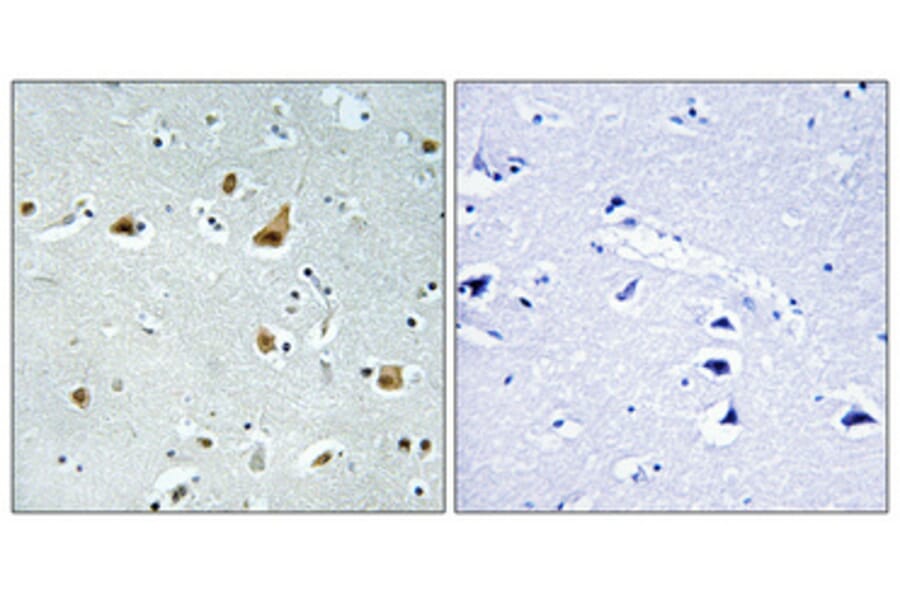 Immunohistochemistry - Anti-RPL5 Antibody (C14187) - Antibodies.com