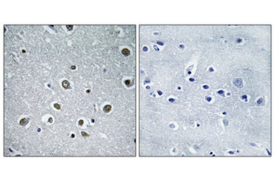 Immunohistochemistry - Anti-RPC8 Antibody (C15481) - Antibodies.com