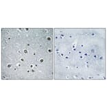 Immunohistochemistry - Anti-RPC8 Antibody (C15481) - Antibodies.com
