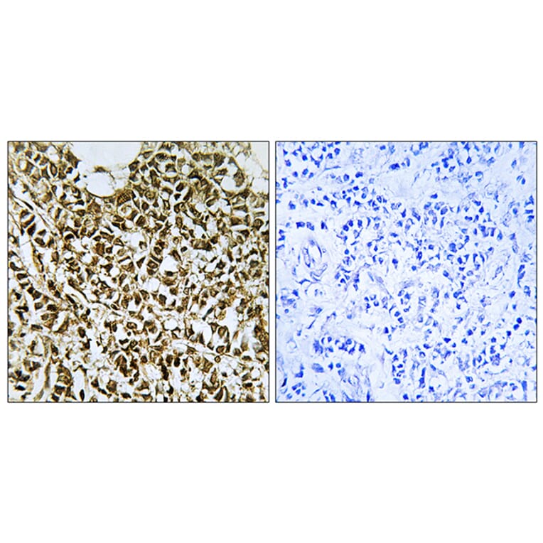 Immunohistochemistry - Anti-RPC5 Antibody (C15478) - Antibodies.com