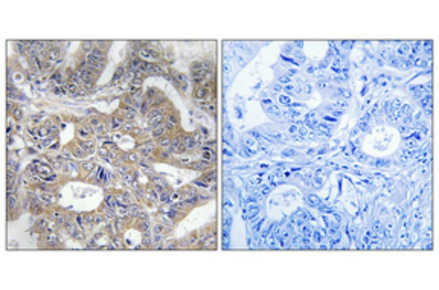 Immunohistochemistry - Anti-RPC5 Antibody (C15478) - Antibodies.com