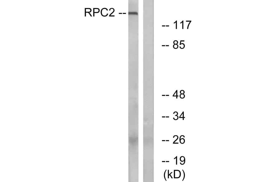 Western Blot - Anti-RPC2 Antibody (C15475) - Antibodies.com