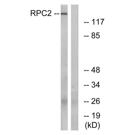 Western Blot - Anti-RPC2 Antibody (C15475) - Antibodies.com