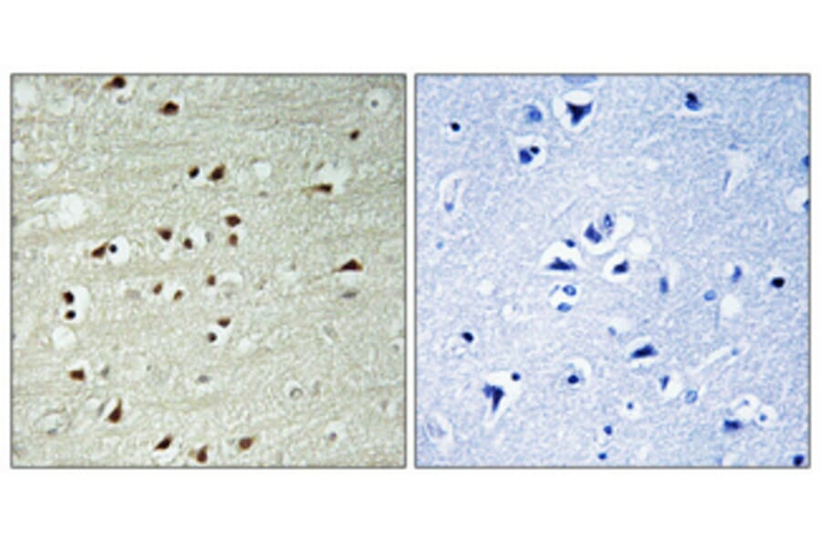 Immunohistochemistry - Anti-RPC2 Antibody (C15475) - Antibodies.com