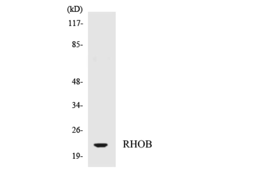 Western Blot - Anti-RHOB Antibody (R12-3438) - Antibodies.com