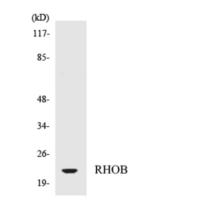 Western Blot - Anti-RHOB Antibody (R12-3438) - Antibodies.com