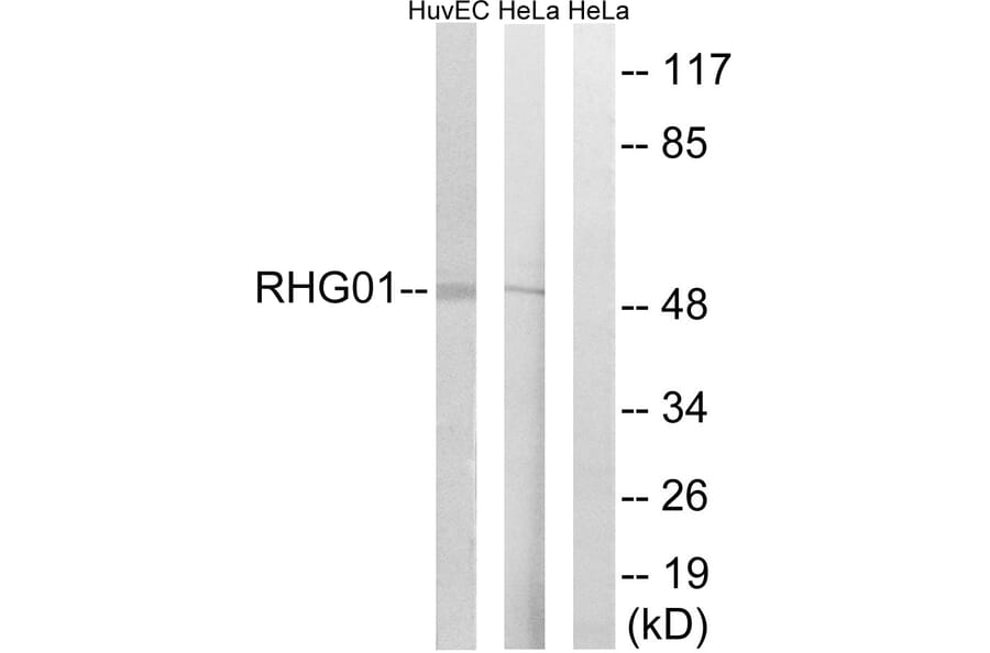 Western Blot - Anti-RHG1 Antibody (C18364) - Antibodies.com